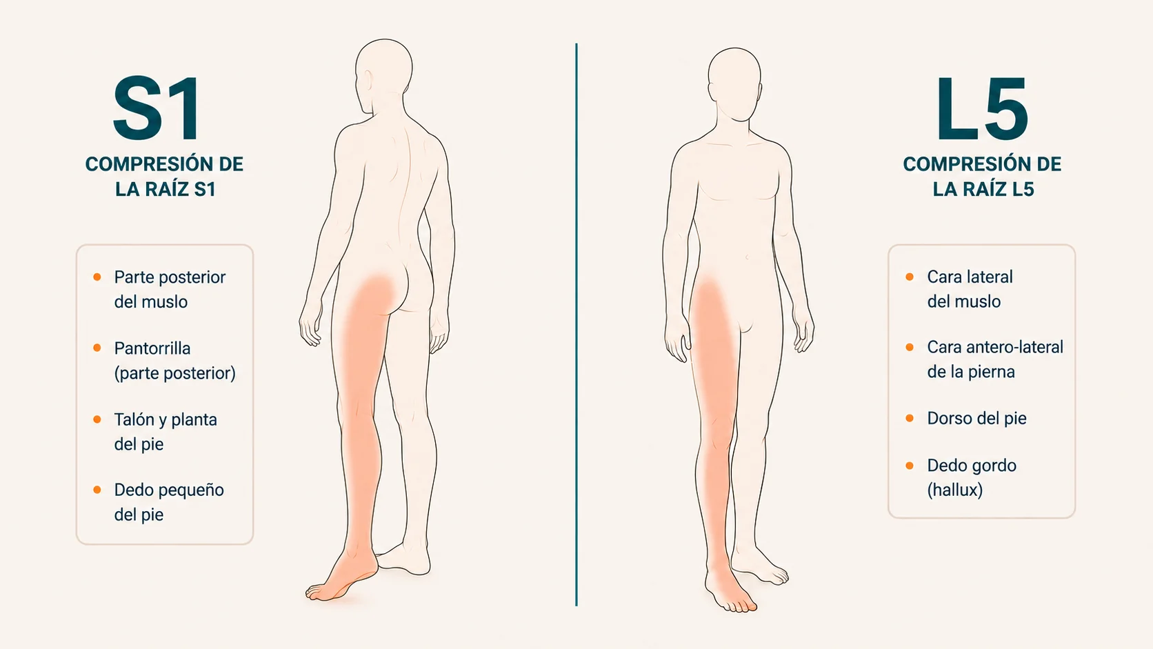 Dos siluetas humanas comparando la distribución del dolor según la raíz nerviosa comprimida (S1 vs L5) en una hernia L5-S1